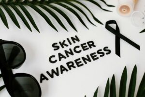 How to Get Clients for Your Skin Cancer Business